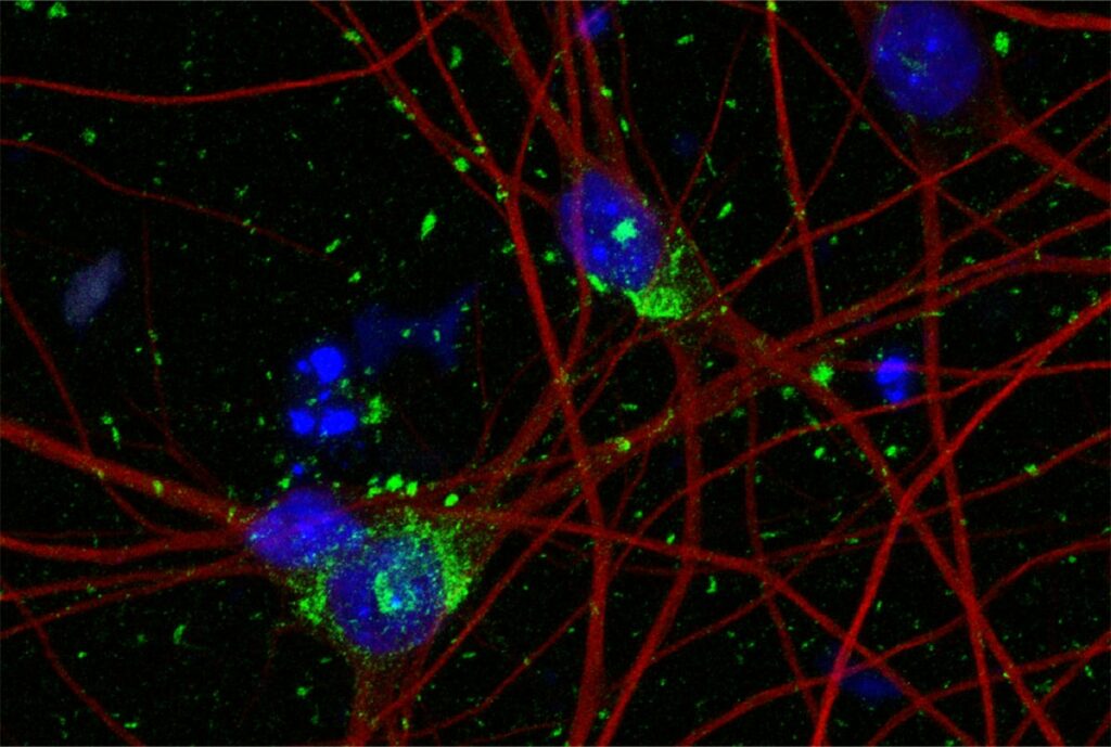 Revolutionizing Alzheimer’s Research: Cornell Scientists Develop Groundbreaking Neuron Model