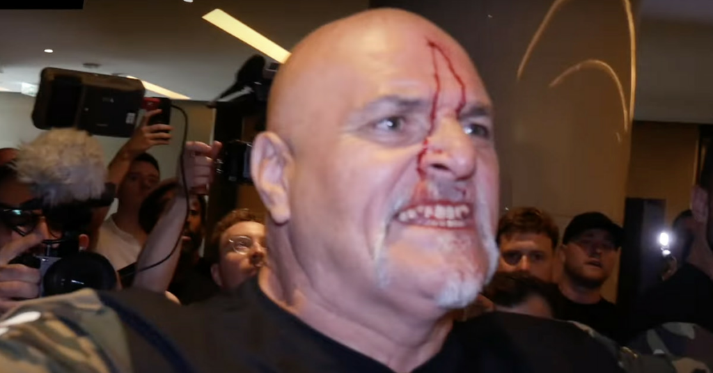 Watch John Fury left bloodied after headbutting Oleksandr Usyk team member
