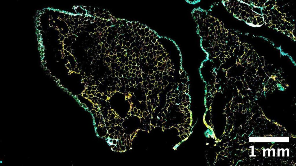 Scientists identified cell populations that could be key to treating obesity