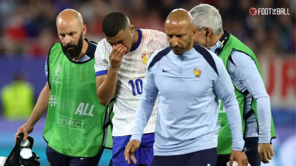 Mbappe to Wear Custom Mask After Suffering Nose Break