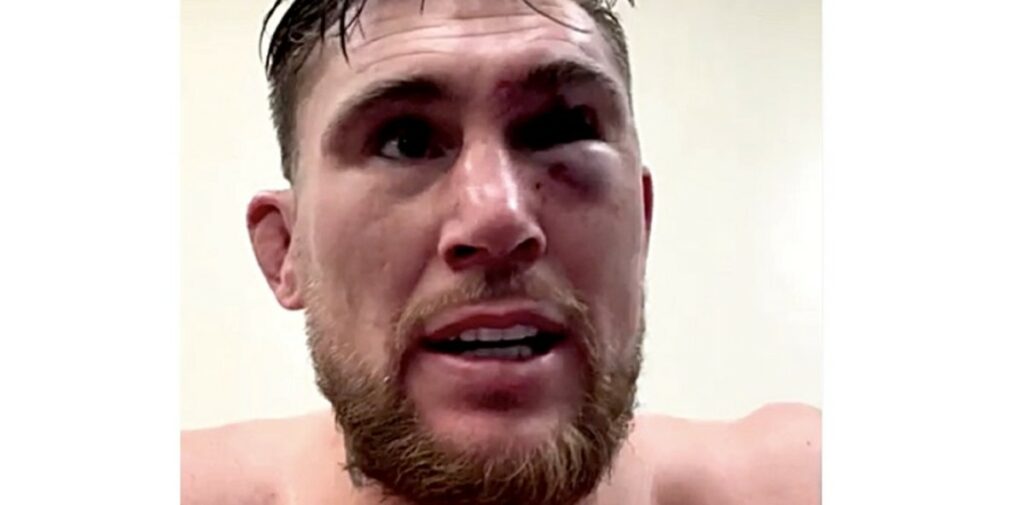 Darren Till involved in huge brawl after unfortunate end to boxing debut