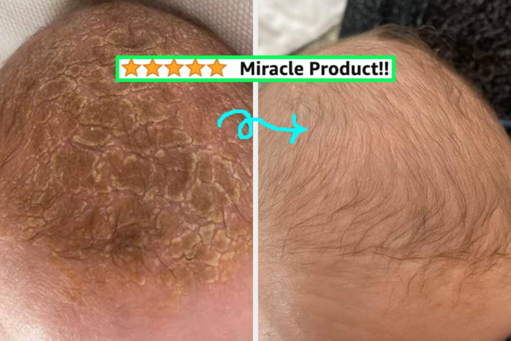 Proceed With Caution, These 30 Products Have Before And After Pics That’ll Shake You Like A Polaroid Picture