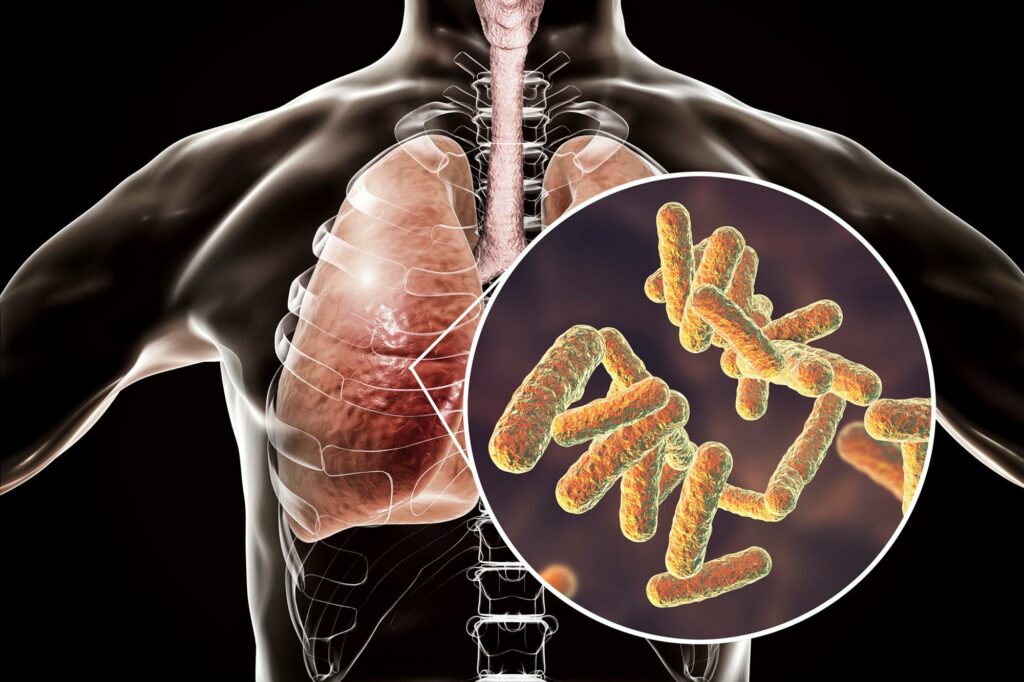 The Invisible Hijackers: How Respiratory Bacteria Sabotage Our Immune System