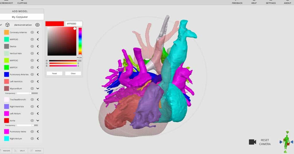 Rady Children’s debuts free 3D image viewing software, available for other providers