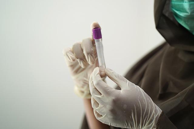 Simple blood tests could be the future of cancer diagnosis – Livescience.com