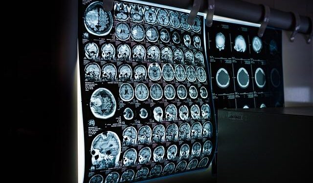 Severance’s consulting neurosurgeon weighs in on the innie/outie science – Boing Boing