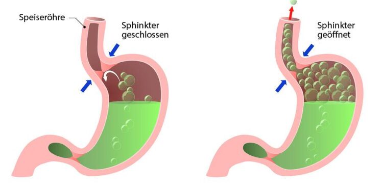 Best Life: Lifestyle changes to reduce the risk of reflux – Action News 5