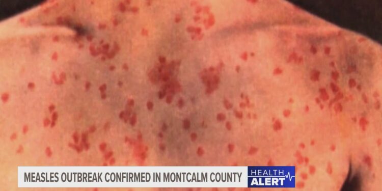 The U.S. is approaching a dangerous measles precipice, scientists say – Los Angeles Times