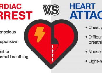 Sudden cardiac arrest: 56 lifestyle factors linked to risk – Medical News Today