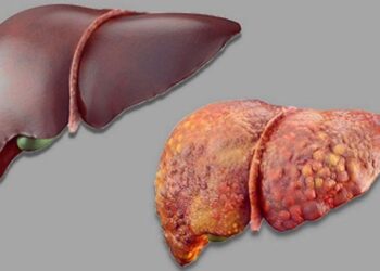 Can liver damage from alcohol be reversed? Doctor reveals truth – Hindustan Times