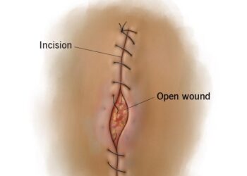 Special Issue of Rangeland Ecology and Management features USGS science in support of the Sagebrush Conservation Design – USGS (.gov)