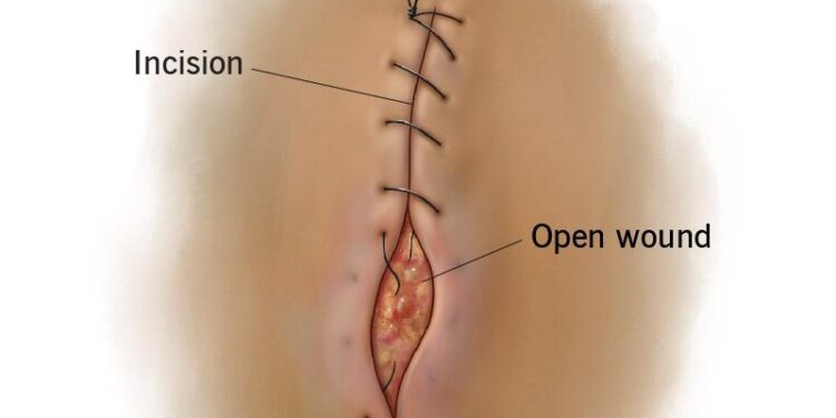 Special Issue of Rangeland Ecology and Management features USGS science in support of the Sagebrush Conservation Design – USGS (.gov)