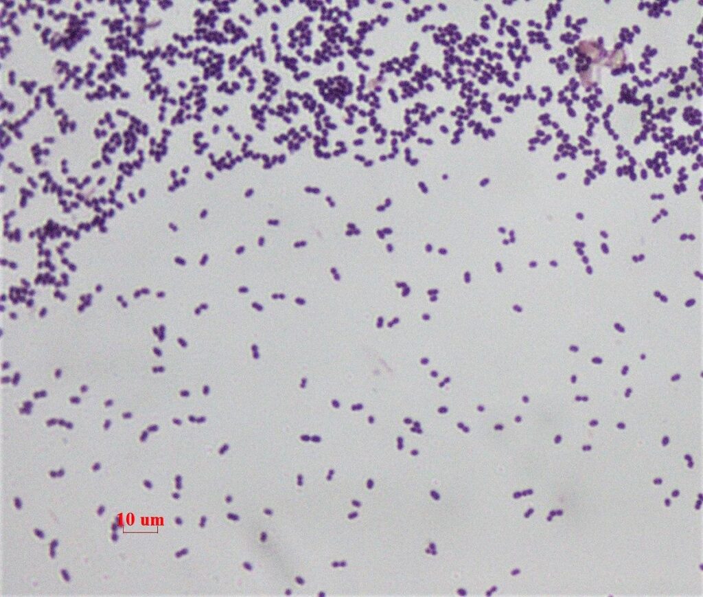 A polymicrobial perspective into the ecological role of Enterococcus faecalis in dental root canal infections – Nature