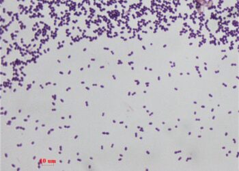 A polymicrobial perspective into the ecological role of Enterococcus faecalis in dental root canal infections – Nature