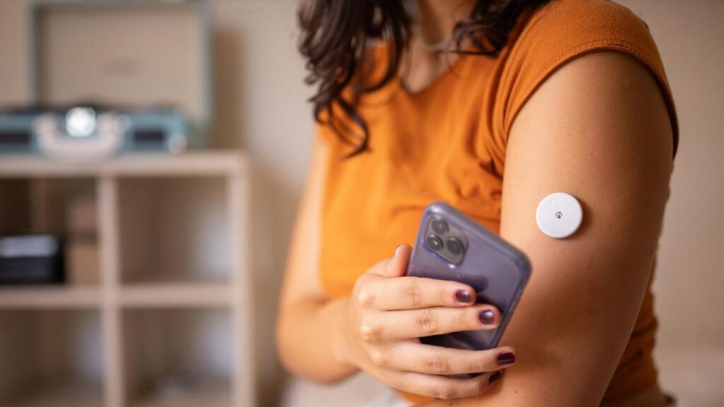 Brief Use of CGM May Enhance Lifestyle Awareness in T2D – Medscape