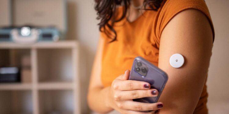 Brief Use of CGM May Enhance Lifestyle Awareness in T2D – Medscape