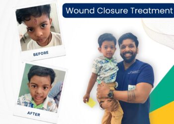 Frontdoor Announces Tech Expert Dr. Bala Ganesh as Chief Technology Officer – Business Wire