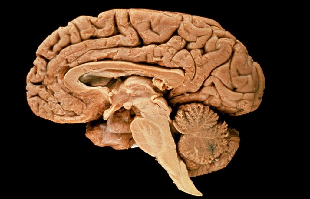 Scientists Merged 3 Human Brains by Thought Alone – Popular Mechanics