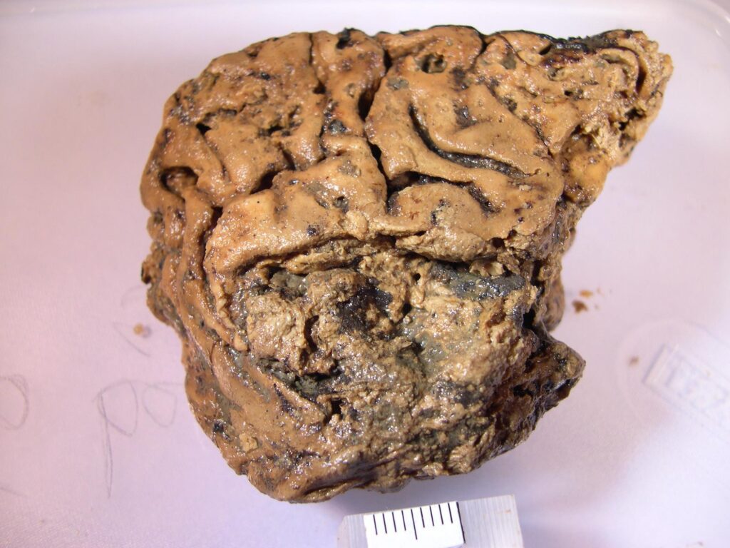 Even old brains can make new neurons, study suggests – Popular Science