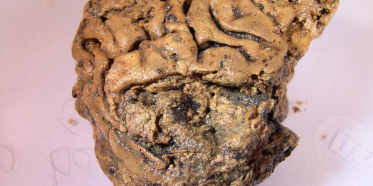 Even old brains can make new neurons, study suggests – Popular Science