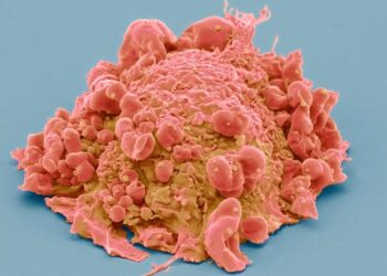 Scientists Develop Glowing Tool To Reveal Cancer Cells – Newsweek