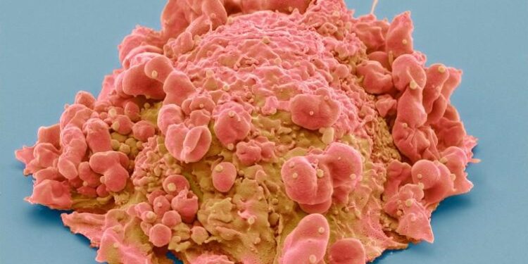 Scientists Develop Glowing Tool To Reveal Cancer Cells – Newsweek