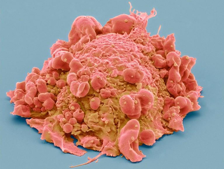 Scientists Develop Glowing Tool To Reveal Cancer Cells – Newsweek