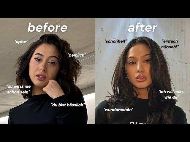 If your goal is to glow up, say goodbye to these 10 daily decisions – VegOut