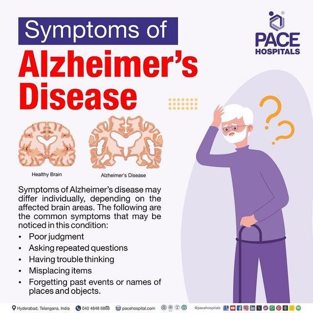 Alzheimer’s progression could be slowed by these changes to lifestyle – The Independent
