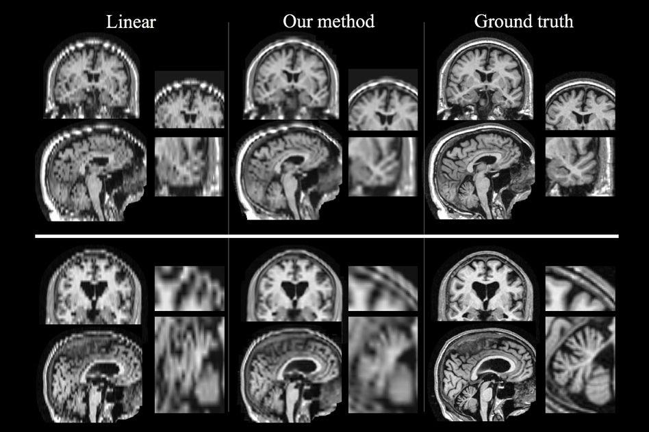Why does your mind goes ‘blank’? New brain scans reveal the surprising answer – Live Science