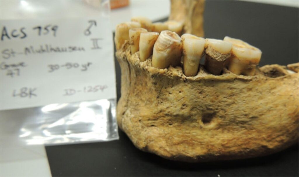 Ancient Dental Plaque Unearths Prehistoric People’s Lifestyle – the-scientist.com