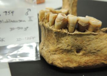 Ancient Dental Plaque Unearths Prehistoric People’s Lifestyle – the-scientist.com