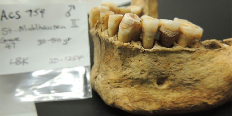 Ancient Dental Plaque Unearths Prehistoric People’s Lifestyle – the-scientist.com