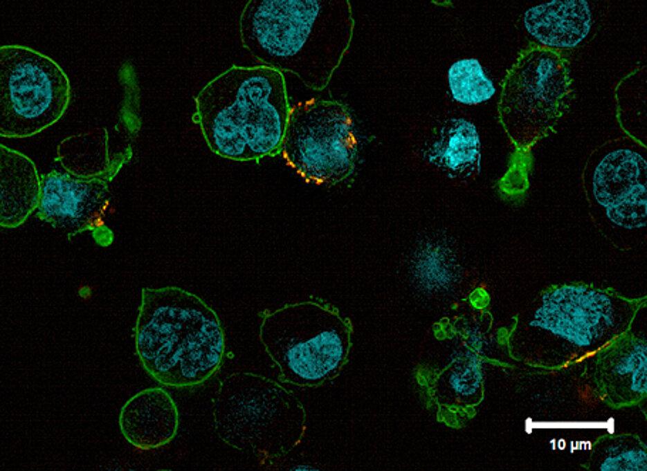 Concerns Emerge Over Potential Cancer Links to Drugs Like Ozempic – ScienceAlert
