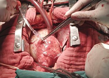 Heart Surgery – UT Health East Texas