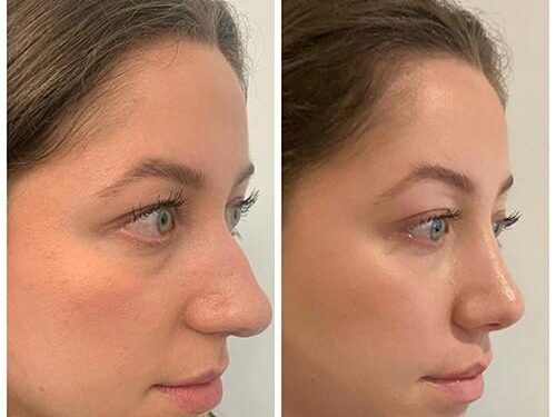 The ancient science of nose jobs : Short Wave – NPR