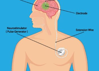 Science and artificial intelligence could help personalize brain stimulation for smokers – News-Medical