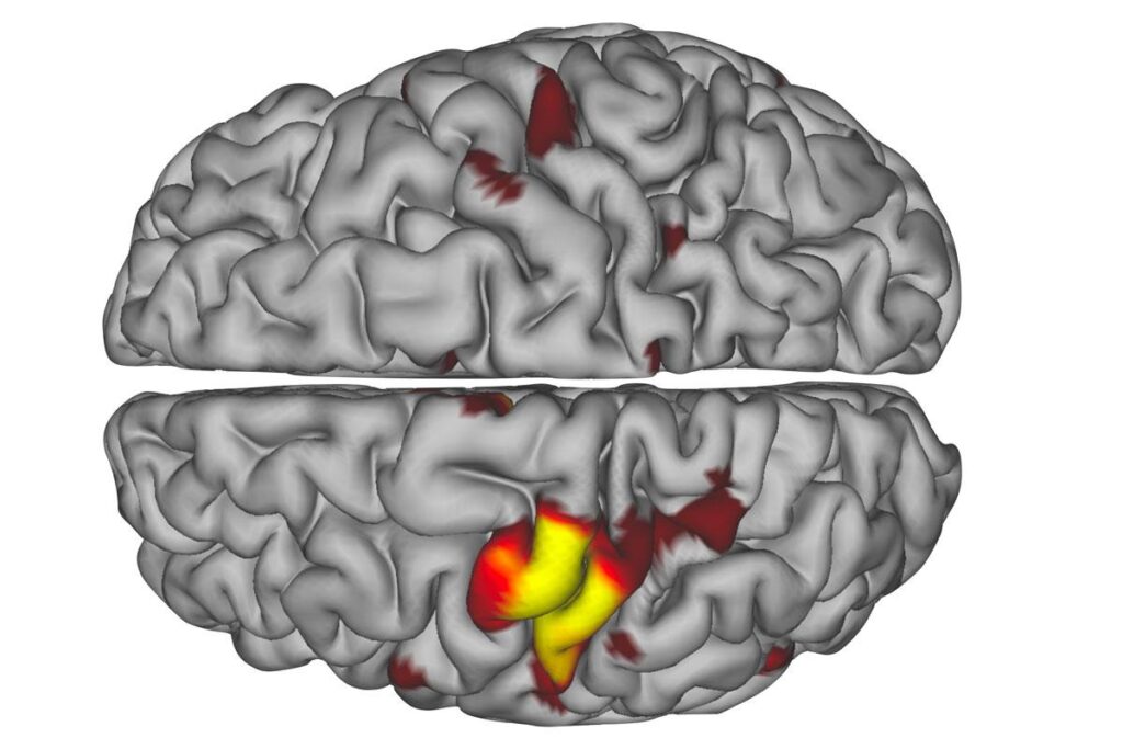 Scientists find the brain’s hidden pulse that may predict Alzheimer’s – ScienceDaily