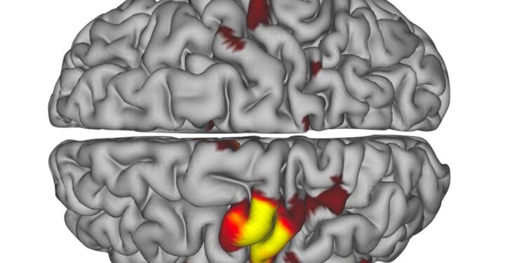 Scientists find the brain’s hidden pulse that may predict Alzheimer’s – ScienceDaily