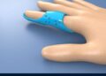Customizable Finger Brace Eases Rehab, Arthritis Care – Black Belt News Network