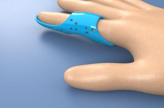 Customizable Finger Brace Eases Rehab, Arthritis Care – Black Belt News Network