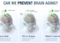 Scientists reversed brain aging and memory loss in mice – Science Daily