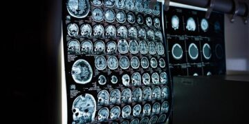 This Medical Technology Leader Sees Profit Growth Topping 44% – Investor’s Business Daily