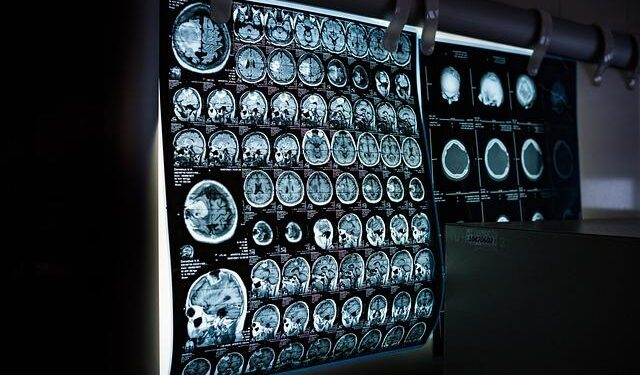 This Medical Technology Leader Sees Profit Growth Topping 44% – Investor’s Business Daily