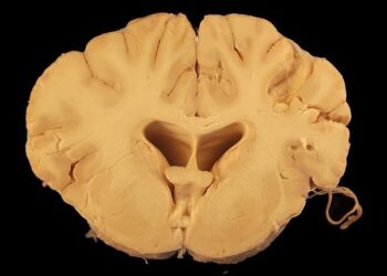 Mysterious State of Matter Discovered Flowing Inside Earth’s Core – ScienceAlert