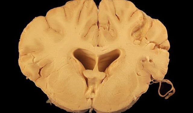 Mysterious State of Matter Discovered Flowing Inside Earth’s Core – ScienceAlert