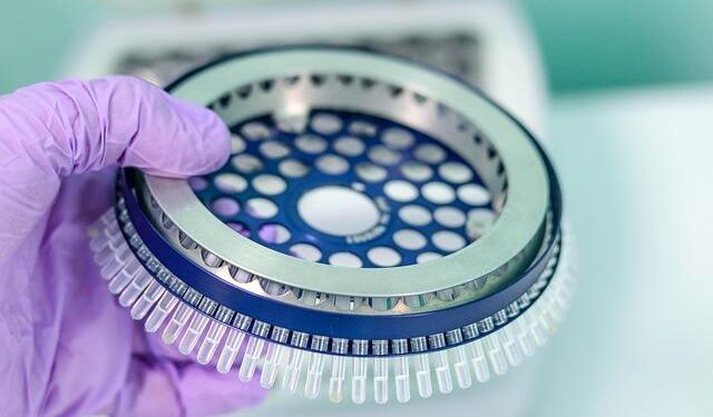 Opinion | A smarter way to fund scientific discovery – The Washington Post